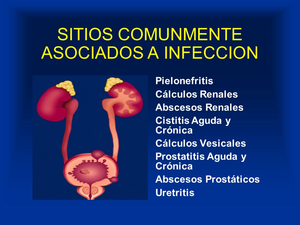 uretritis cronica que es